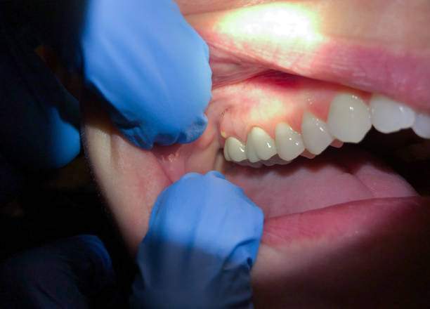 Best Weekend Emergency Dentist in Diamond, IL